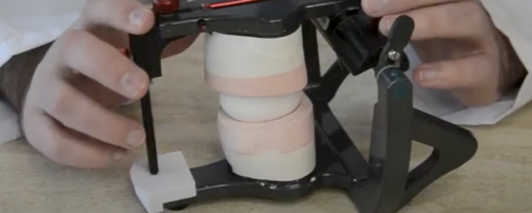 Egg on Dental Articulator - Michael Verber, DMD